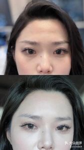 女生额头向后倾斜照片_女生额头像小斜坡，个性十足！你觉得是力量还是温柔？